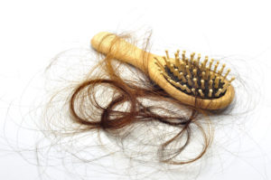 Salon-M Hair Salon & Trichology Clinic In Wallasey, The Wirral Offers Treatments For Coronavirus Hair Loss