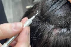 Mesh Hair Integration, Top Wallasey Hair Loss Clinic